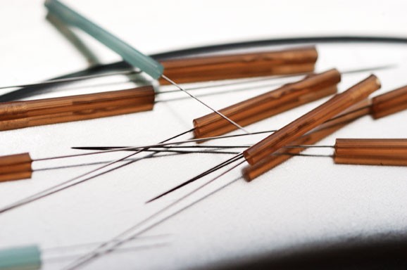 Traditional Chinese medicine (TCM) belongs to the oldest successfully methods in the world.