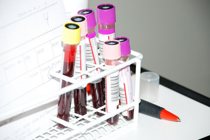 Blutabnahme Blutwerte c littlebell fotolia Gesundheitscheck Vorsorgeuntersuchung Diagnoseklinik